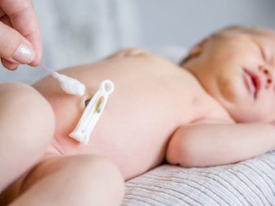 Nabelpflege Baby: Das sollten Eltern beachten