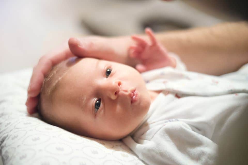 Der Kopfgneis: Hauterkrankungen am Kopf von Neugeborenen