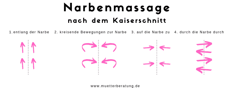 Narbenmassage nach dem Kaiserschnitt. Anleitung. Die verschiedenen Massagetechniken.
