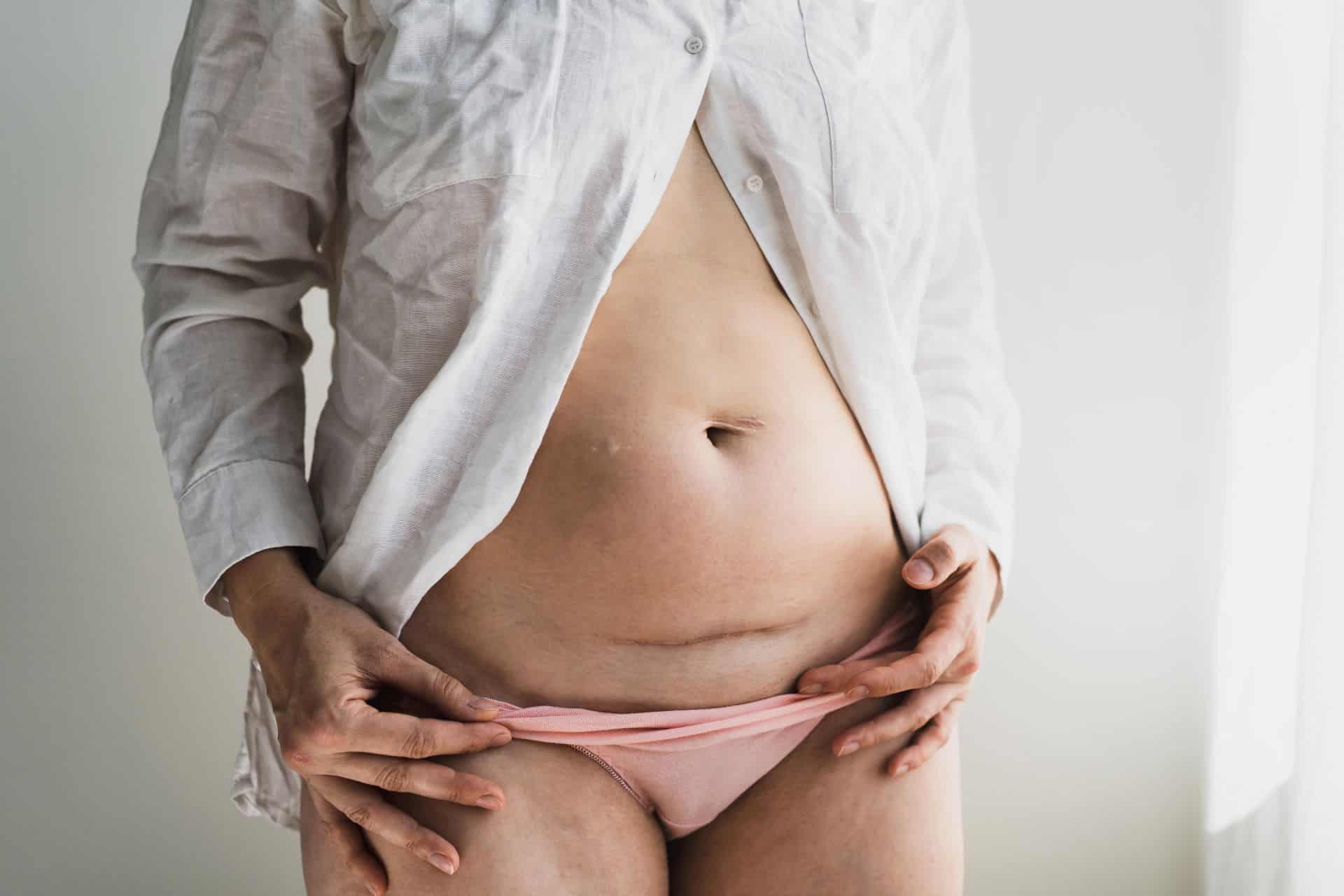 Rückbildung nach Kaiserschnitt: Spezielle Übungen & Kurse